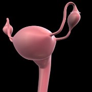 Out of Place: the Ectopic Pregnancy